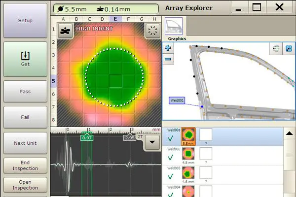 Software ultrasonido Tessonics